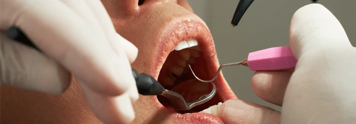FC – Immediate Emergency Dental Care at Brilla Dental Group in Santa Maria CA